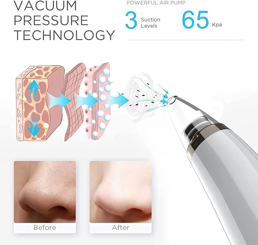 5 in 1 Electric Blackhead Acne Oil Remover